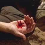 Triệu chứng chẩn đoán và các biến chứng của bệnh tim đối với thai nghén