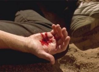 Triệu chứng chẩn đoán và các biến chứng của bệnh tim đối với thai nghén