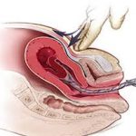 Một số điều cần biết về chảy máu sau sinh do đờ tử cung