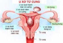 Đại thể, vi thể và tiến triển của u.