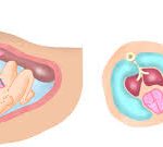 Một số bài thuốc nam chữa nôn mửa trong cộng đồng