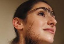 Một số điều cần biết về chứng rậm lông và chứng nam tính hóa ở nữ giới