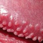 Các bài thuốc hòa giải hay dùng trong y học cổ truyền