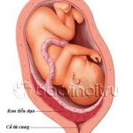 Những điều cần biết về các phương pháp xử trí rau tiền đạo