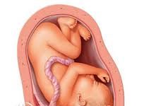 Những điều cần biết về các phương pháp xử trí rau tiền đạo