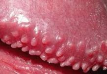 Các bài thuốc hòa giải hay dùng trong y học cổ truyền