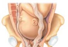 Một số điều chị em cần chú ý về đẻ khó do sa dây rau trong chuyển dạ