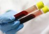 Xét nghiệm máu
