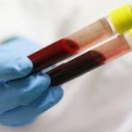 Xét nghiệm máu