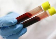 Xét nghiệm máu