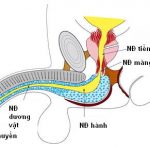 Diễn biến và biến chứng của đứt niệu đạo sau.