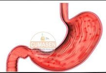 Lâm sàng các thể viêm dạ dày hiếm gặp