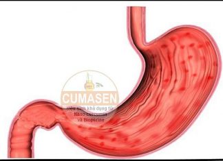 Triệu chứng lâm sàng viêm dạ dày cấp