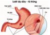 BIẾN CHỨNG CỦA LOÉT DẠ DÀY TÁ TRÀNG