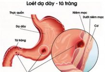 BỆNH SINH LOÉT DẠ DÀY TÁ TRÀNG