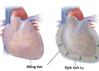 Bệnh sinh bệnh viêm nội tâm mạc nhiễm khuẩn.