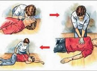 Cấp cứu ngừng tim phổi