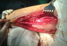 Động mạch cánh tay có cấu trúc giải phẫu ra sao hay cùng tìm hiểu