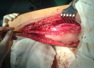 Động mạch cánh tay có cấu trúc giải phẫu ra sao hay cùng tìm hiểu