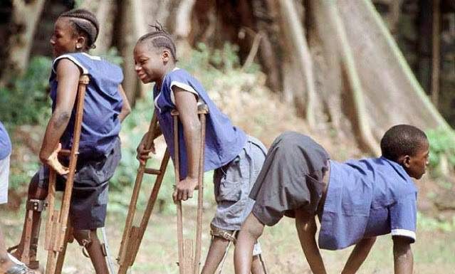 GIẢI ĐÁP THẮC MẮC XUNG QUANH BỆNH BẠI LIỆT Ở TRẺ EM