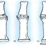 Đặc điểm và vị trí giải phẫu của tất cả các xương bàn tay