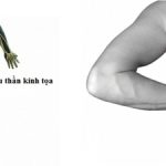 Những nguyên nhân dẫn tới đau dây thần kinh hông to (phần 1)