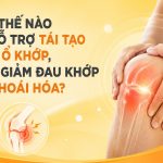 LÀM THẾ NÀO ĐỂ HỖ TRỢ TÁI TẠO DỊCH Ổ KHỚP, LÀM TĂNG TÍNH VẬN ĐỘNG LINH HOẠT CỦA KHỚP, GIÚP GIẢM ĐAU KHỚP DO THOÁI HÓA KHỚP? Làm thế nào để tái tạo dịch ổ khớp, giảm đau do thoái hóa khớp?
